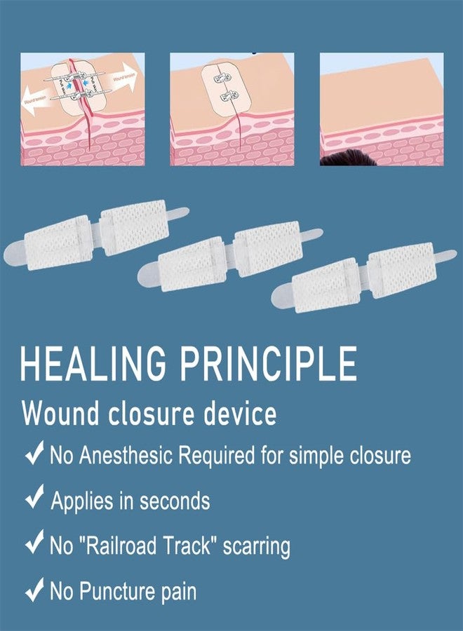Yeasing Wound Closure Strips 3PCS Butterfly Wound Closure Suture Strip Butterfly Bandages Butterfly Bandages Emergency Laceration Closure Kit for Lacerations Incisions Cuts - Image 5